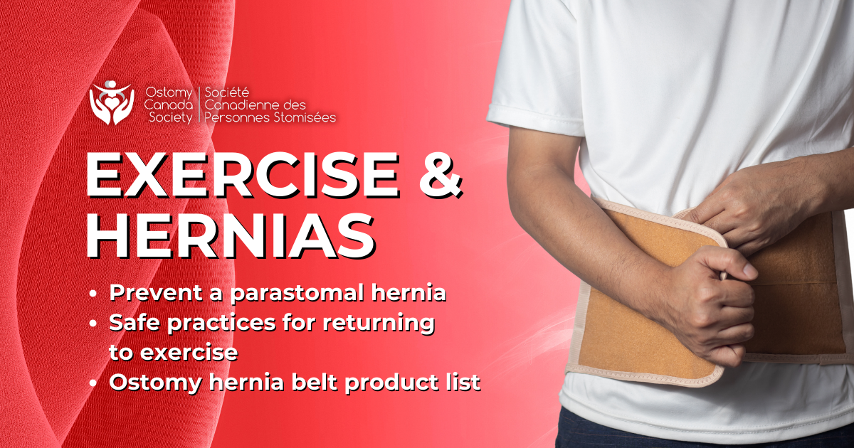Preventing Parastomal Hernias